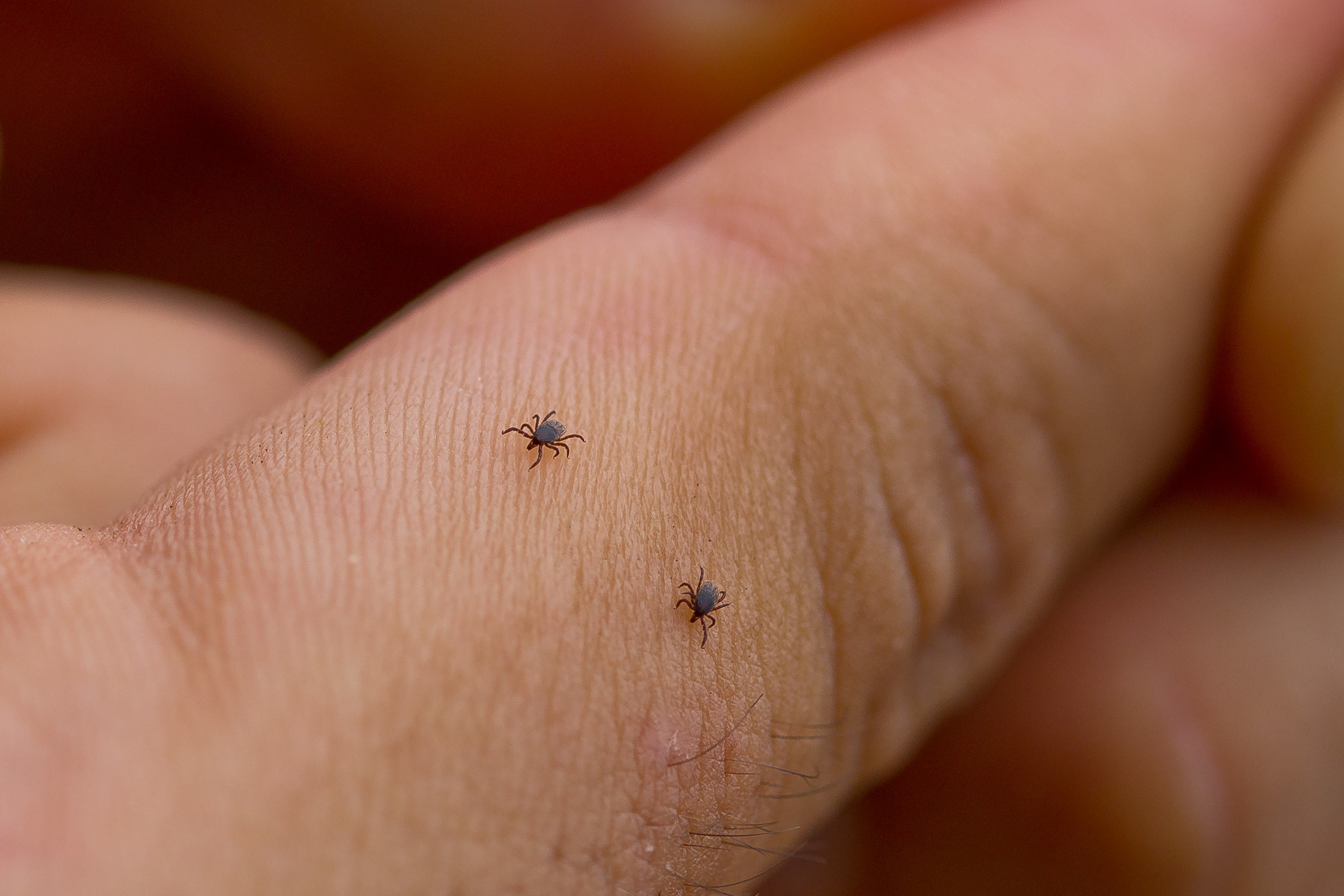 How Do I Know if I Have Lyme Disease? | The Medical Center of Aurora